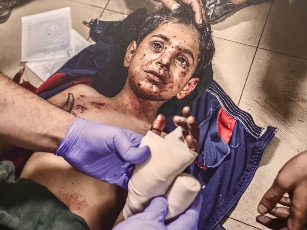 Gaza bajo el ataque de Israel (World Press Photo Categoria Reportajes Gráficos)