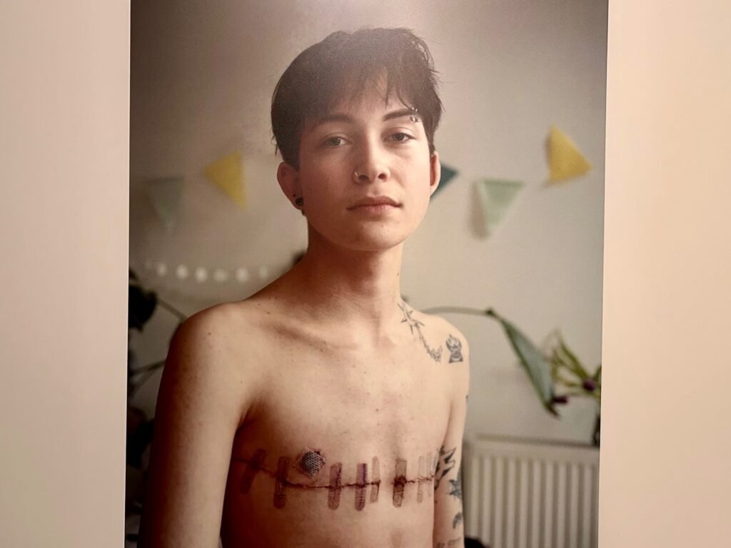 Mika. World Press Photo category individuales.